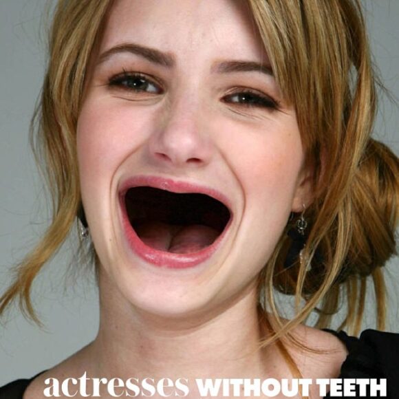 celebrities with dentures