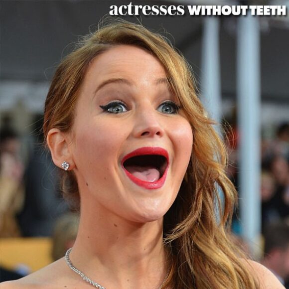 celebrities with dentures